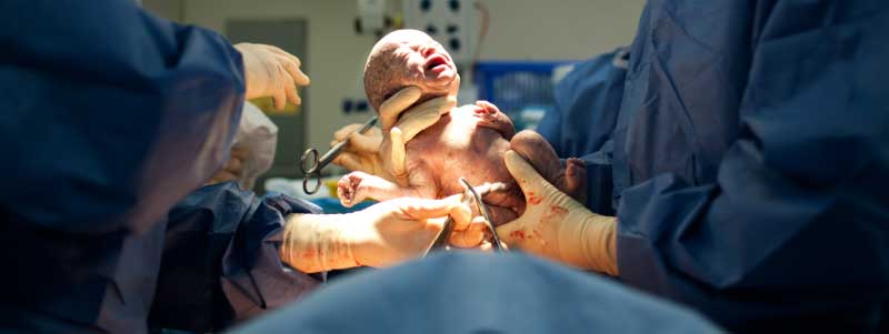 What You Need to Know About Shoulder Dystocia and Related Birth Injuries What You Need to Know About Shoulder Dystocia and Related Birth Injuries